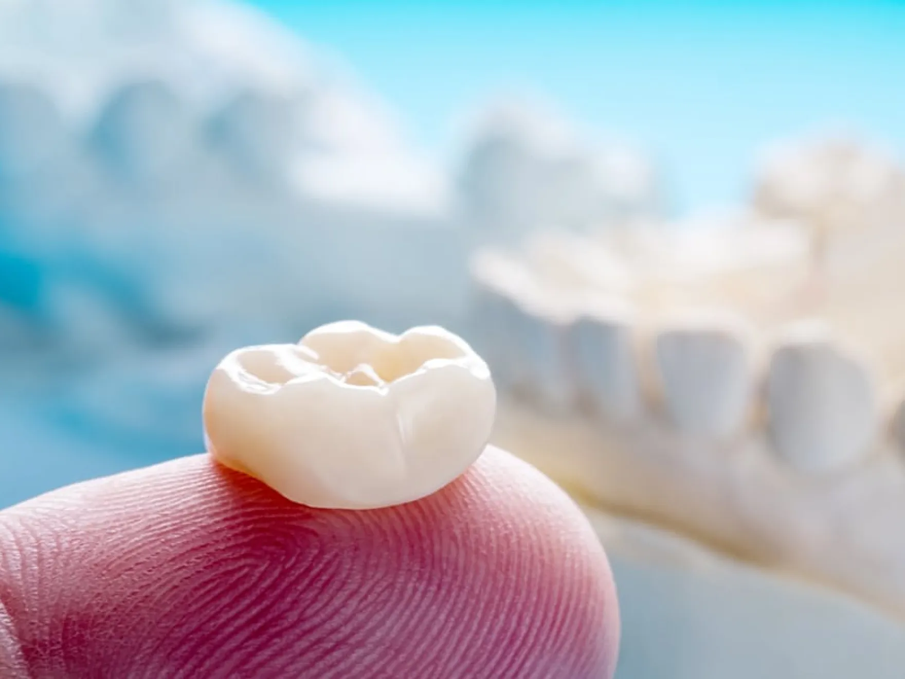 Dental crown in Mt. Airy, MD